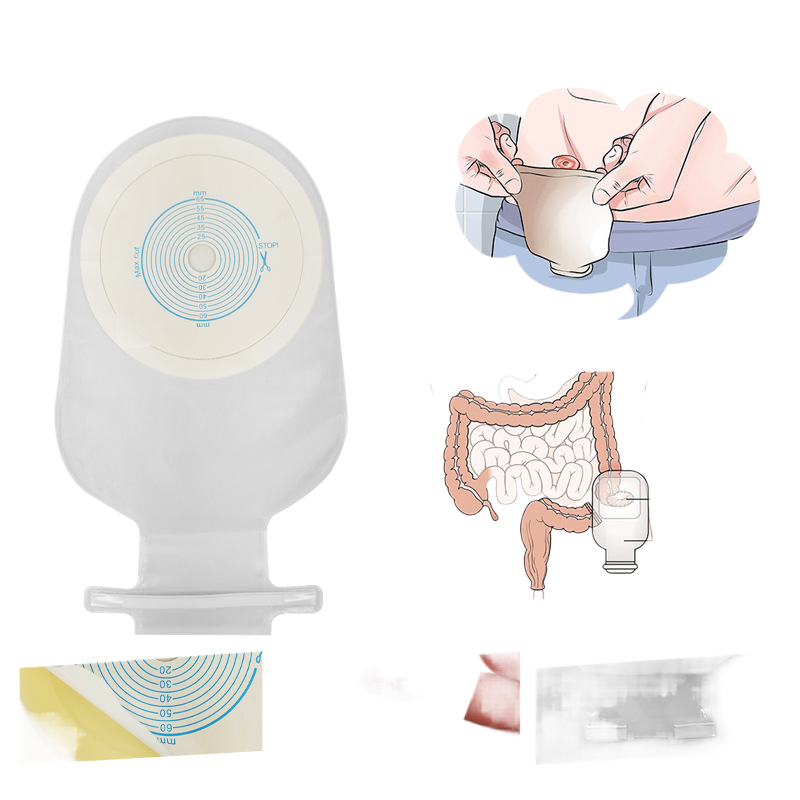 One-Piece Disposable Colostomy Bag with Open End
